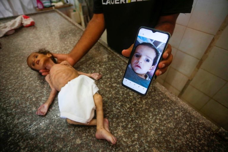 AA-20250627-38406084-38406077-USHTE_EDNO_TRIMESECHNO_BEBE_POCHINA_OD_NEISKHRANETOST_VO_GAZA_PORADI_IZRAELSKATA_BLOKADA